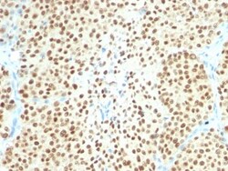 SOX10 Antibody (SPM607), Novus Biologicals 0.2mg; Unlabeled:Antibodies,